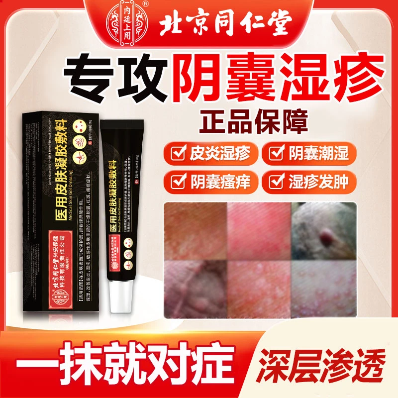内廷上用私处瘙痒湿疹阴囊专用 潮湿湿疹 男性私处下面痒大腿内侧瘙痒红斑瘙痒 脱屑皮炎外用医用皮肤凝胶敷料