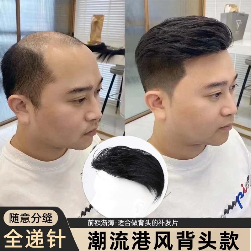 男士假发港风背头补发片真发全真人发四周生物头皮隐形头顶假发片
