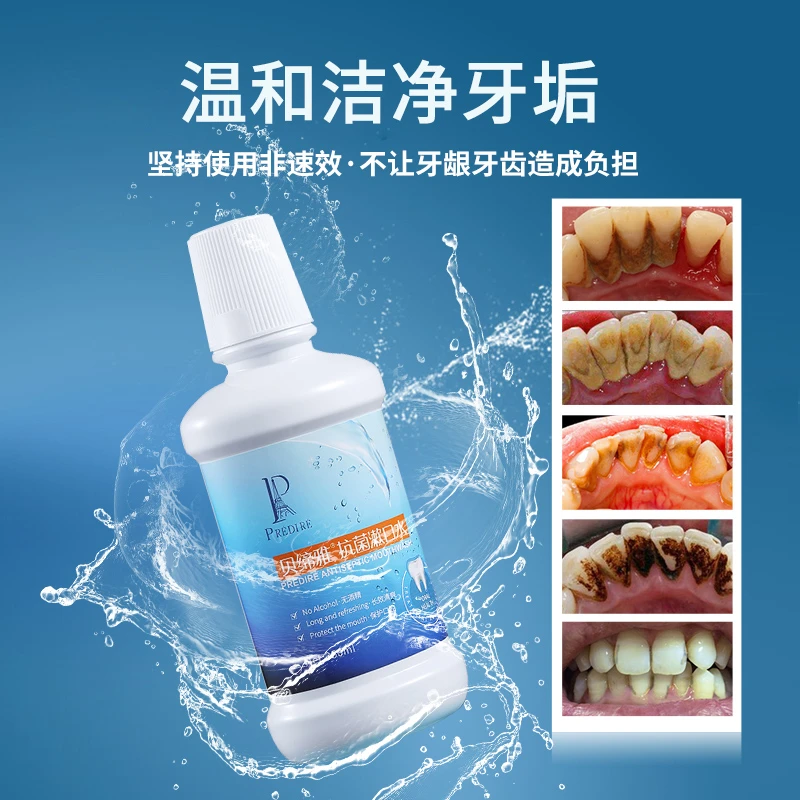 贝缔雅漱口水牙刷套餐FXH