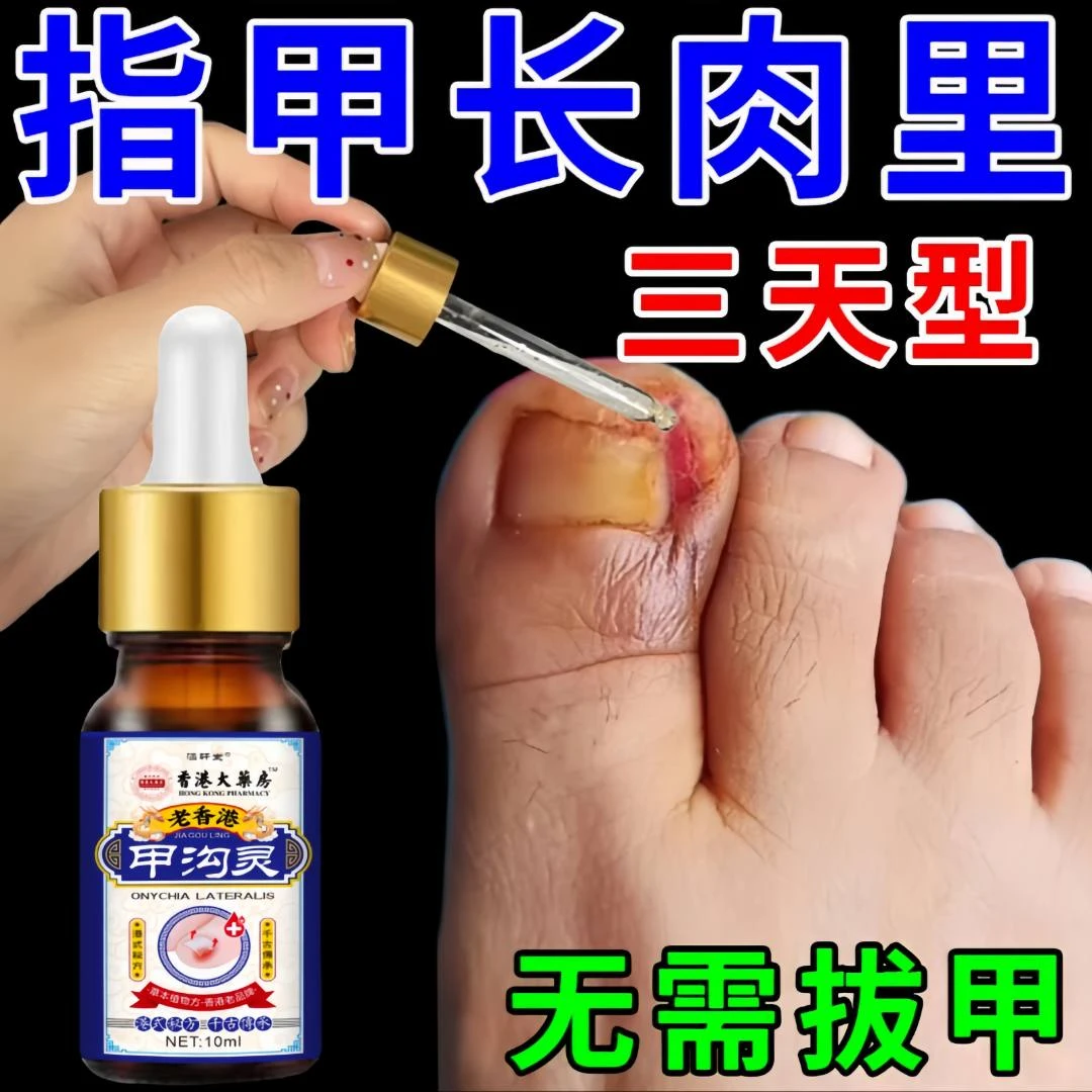 指甲长肉里甲沟肿大有脓包软甲脱甲脚指甲化脓脚趾头专用甲沟液
