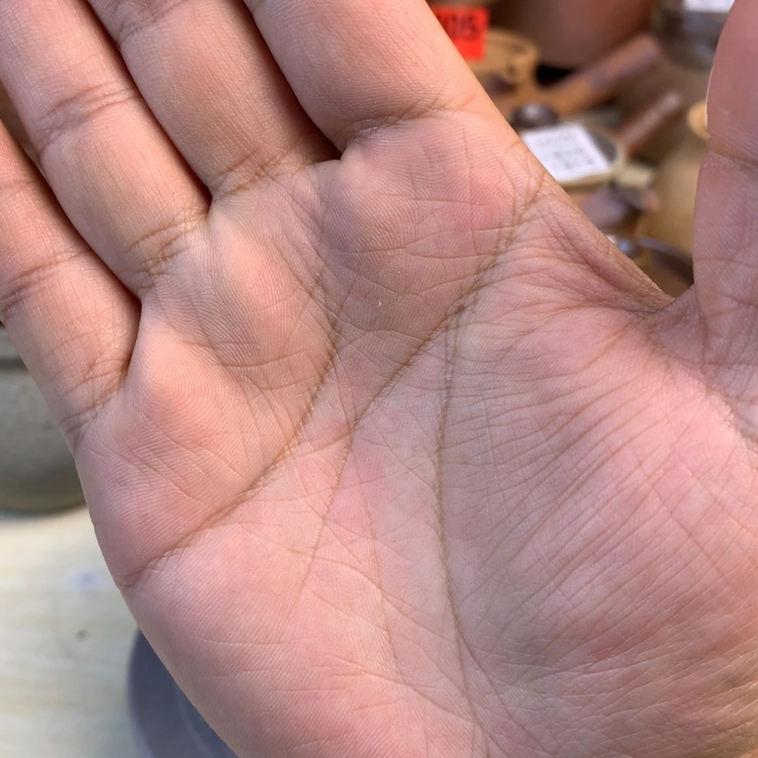 微瑕。福利福利待遇怎么样