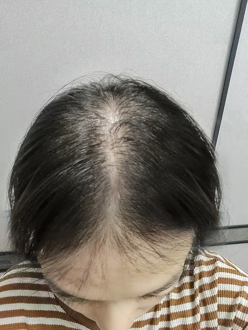 看主播以前照片梳子