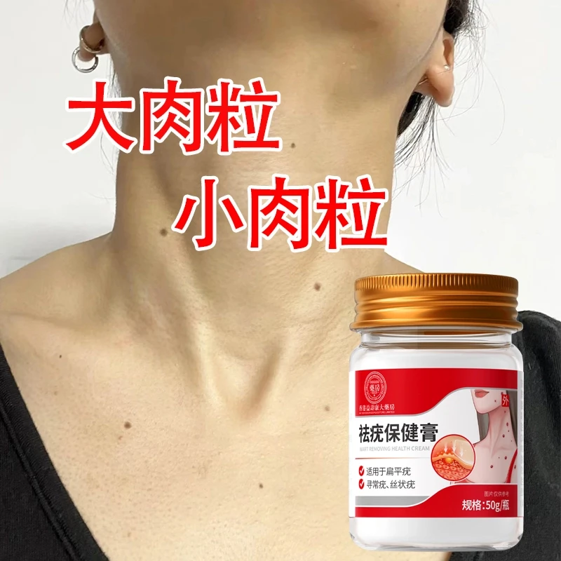 药康仁保健膏温和不刺激小肉粒肉瘊子寻常小肉粒