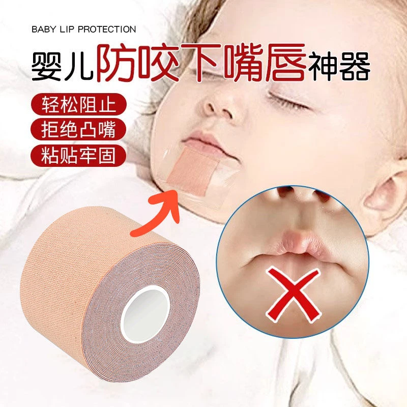吸预防宝宝儿童睡觉戒宝宝咬下嘴唇矫正神器护理透气防咬多功能
