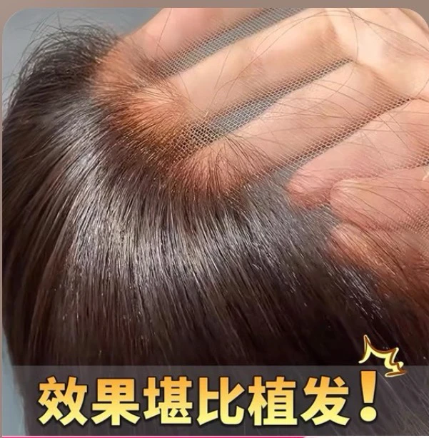 A“裸感无边”超隐形头顶补发片全真发，遮盖白发补充发S