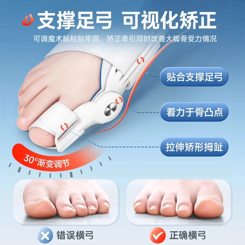 脚趾矫正神器拇外翻分趾器纠正脚骨头突出重叠防磨分趾器无痛分离