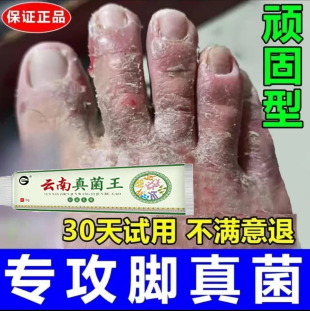 【官方正品】真菌王手足护理膏植物草本温和脚脱皮开裂草本抑菌乳膏