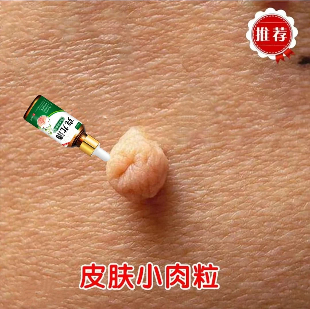 克尤清脖子手足腋下丝状扁平肉刺身体草本