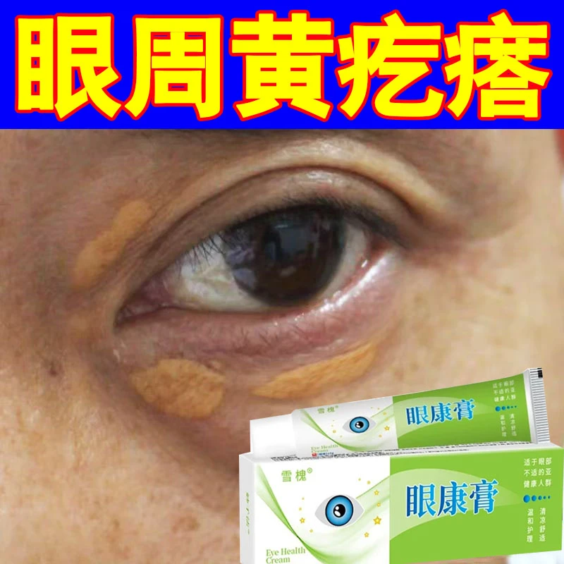 眼部眼睑黄溜眼周黄斑黄色褐色小疙瘩凸起小颗粒肉粒专用草本膏