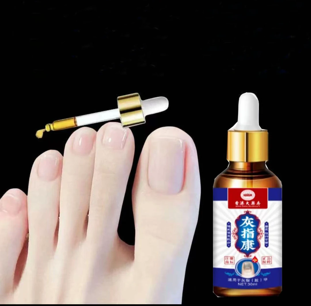 【顽固灰甲】严重指甲黄灰增厚抑菌指甲发黑坏甲正品草本指甲软化剂