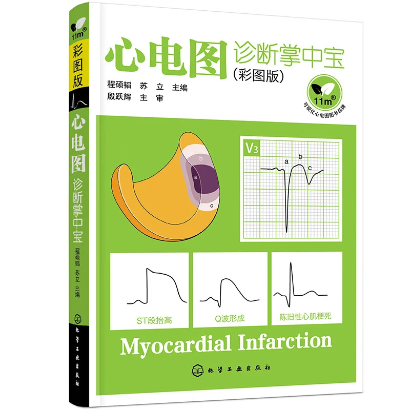 心电图诊断掌中宝彩图版 临床医师看心电图方法技巧