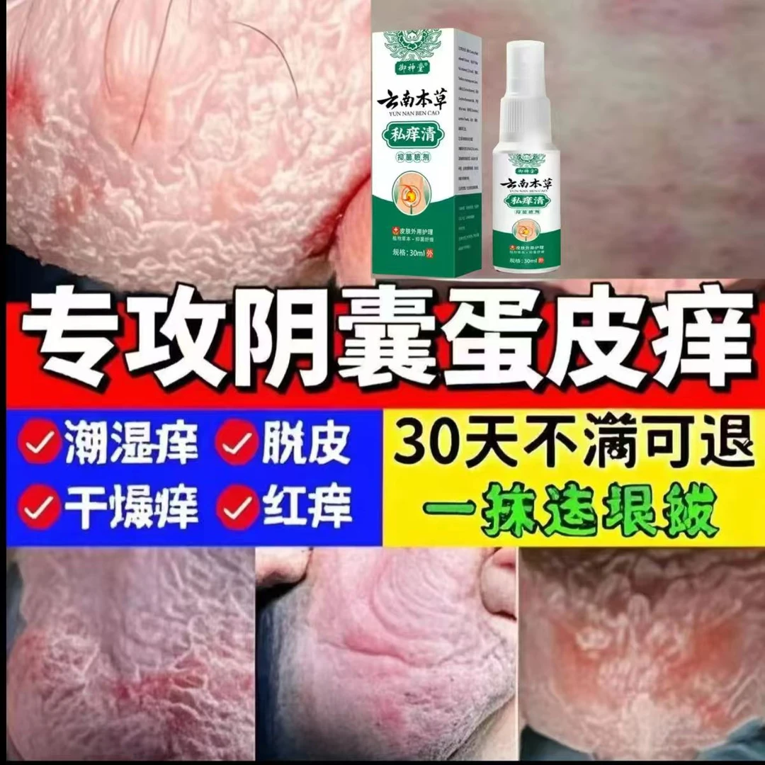 云南本草男性私处阴囊潮湿异味大腿内侧瘙痒越抓越痒止痒抑菌喷雾