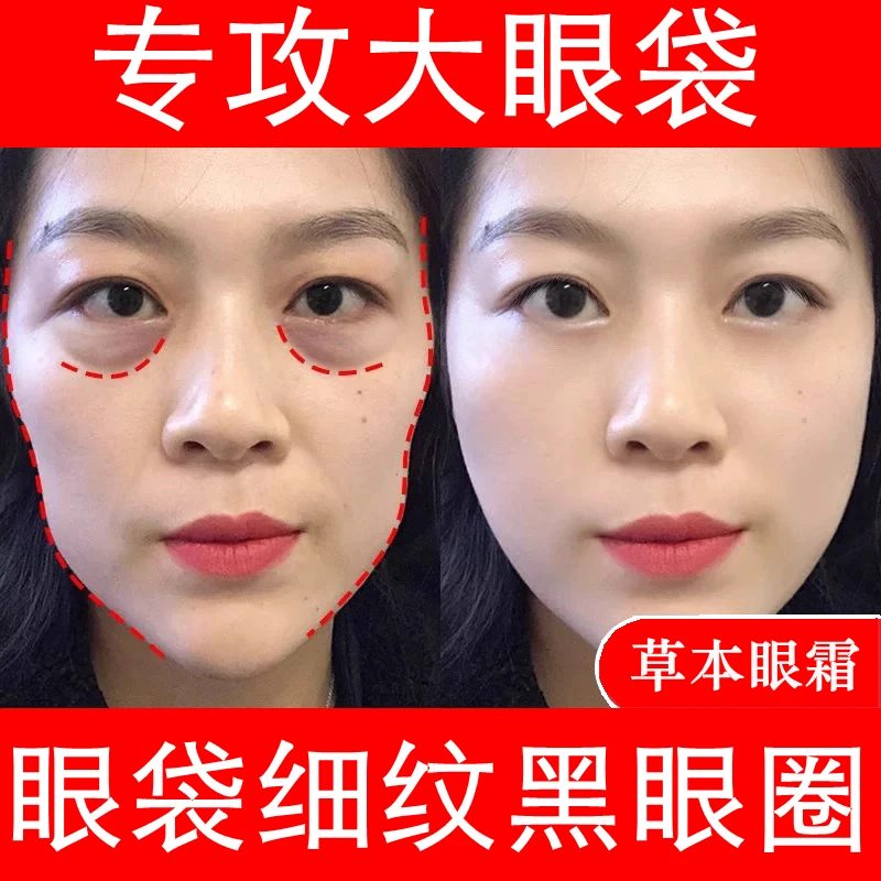 改善细纹黑眼圈男女士眼部精华油草本眼霜保湿补水眼袋消除神器