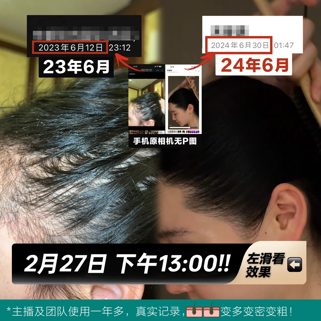 2月27号下午一点！想炸毛必吃这个！看主图！厚！多！蓬！NF 黄金胶囊