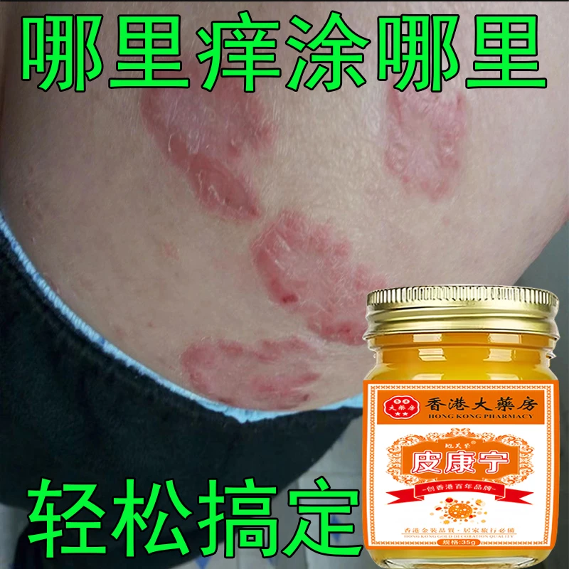 【香港皮康宁】牛皮肤银屑膏头藓顽固手足股止痒大腿内侧痒全身可用