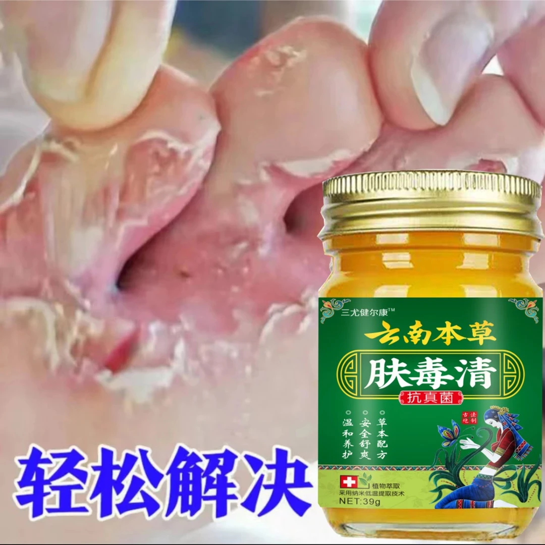 止痒膏脚出汗脱皮涂抹干裂脚趾缝痒抑菌止痒神器足部护理止痒软膏