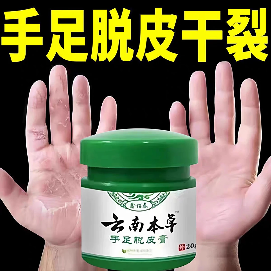 正品云南真菌王脚后跟起皮粗糙干裂起硬皮手开口干裂防裂膏