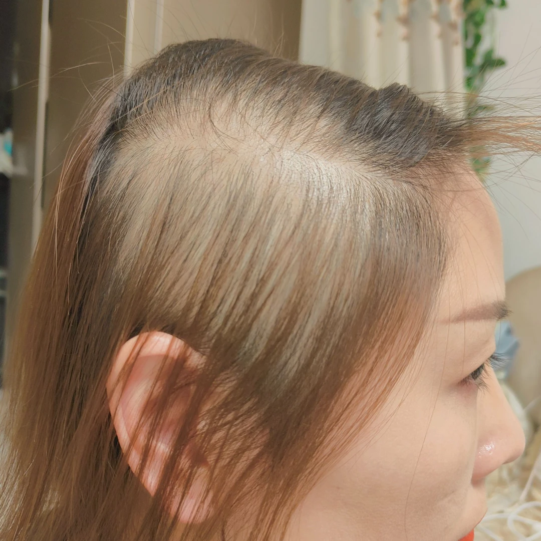 主播使用前照片（气垫梳）