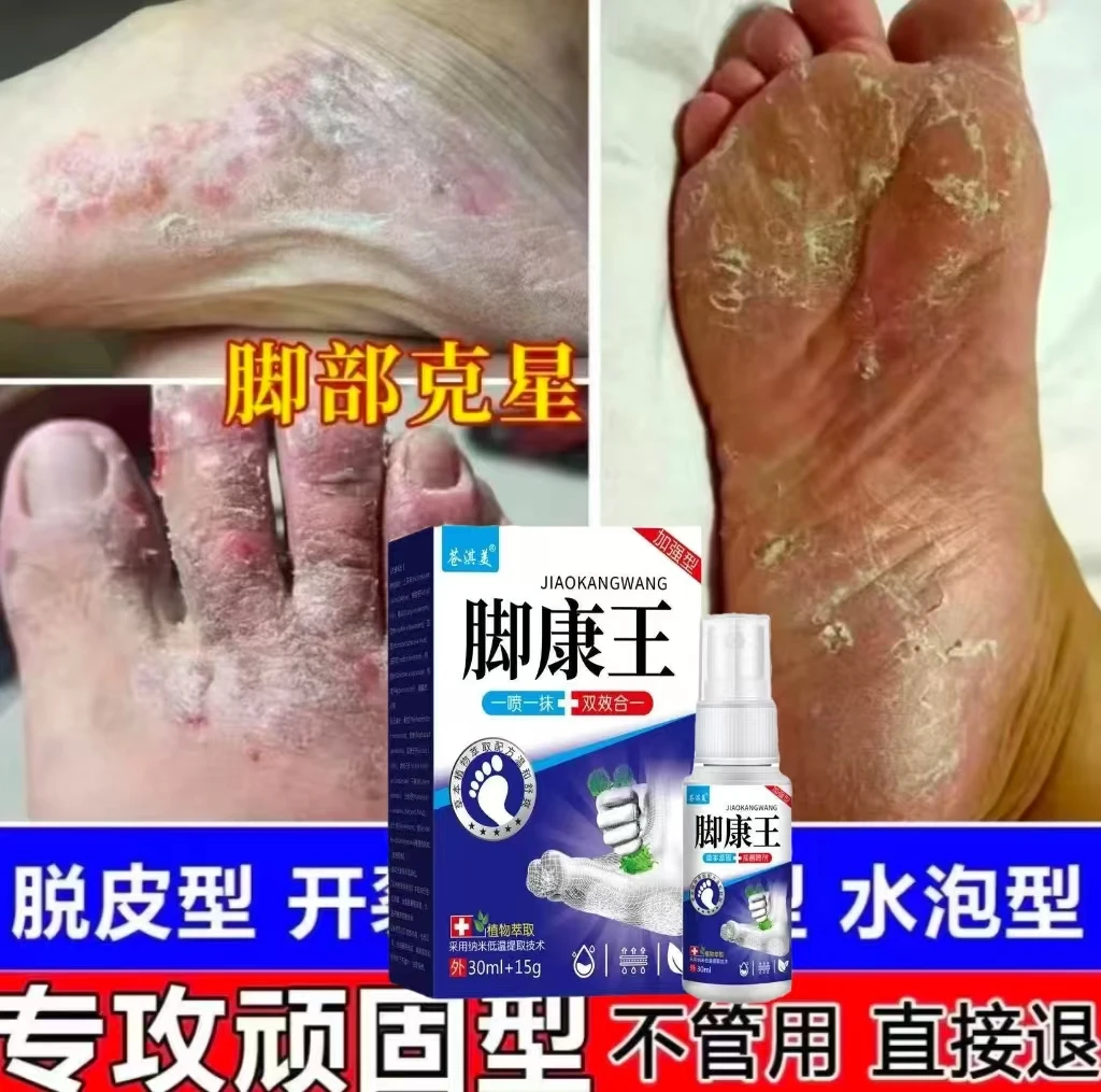 脚底板脱皮瘙痒脚掉皮蜕皮治脚臭止痒专用杀菌烂脚丫真菌感染药膏
