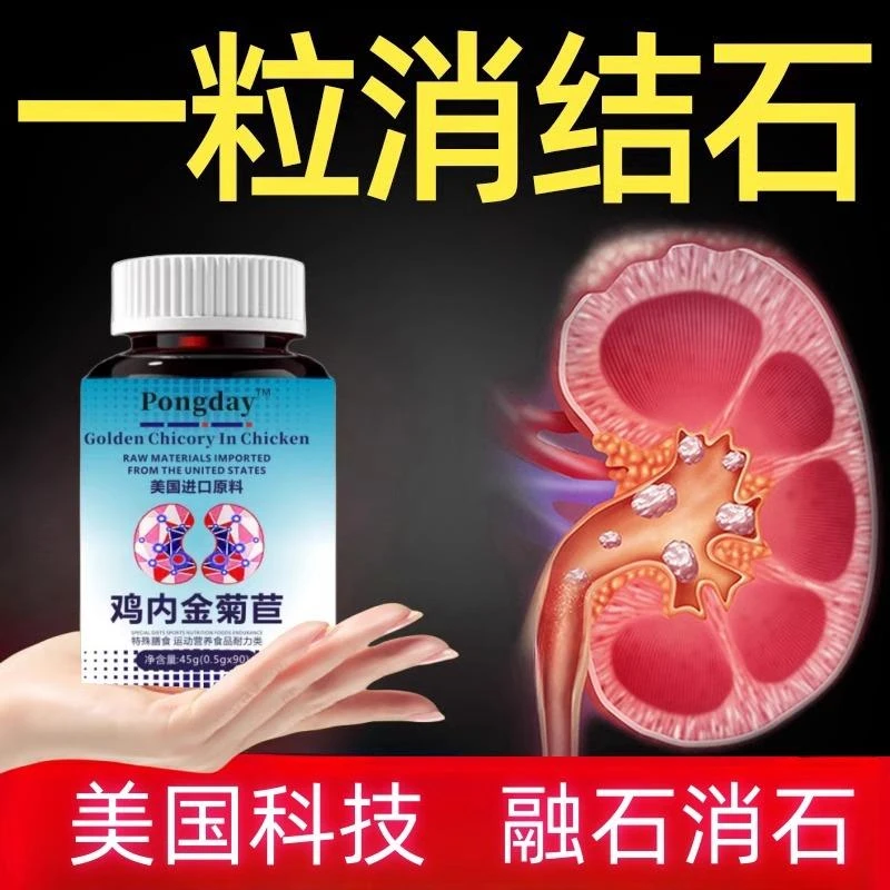 胆肾和囊结石溶石化石排石专用的药治疗鸡内金碎石丸尿特效输尿管