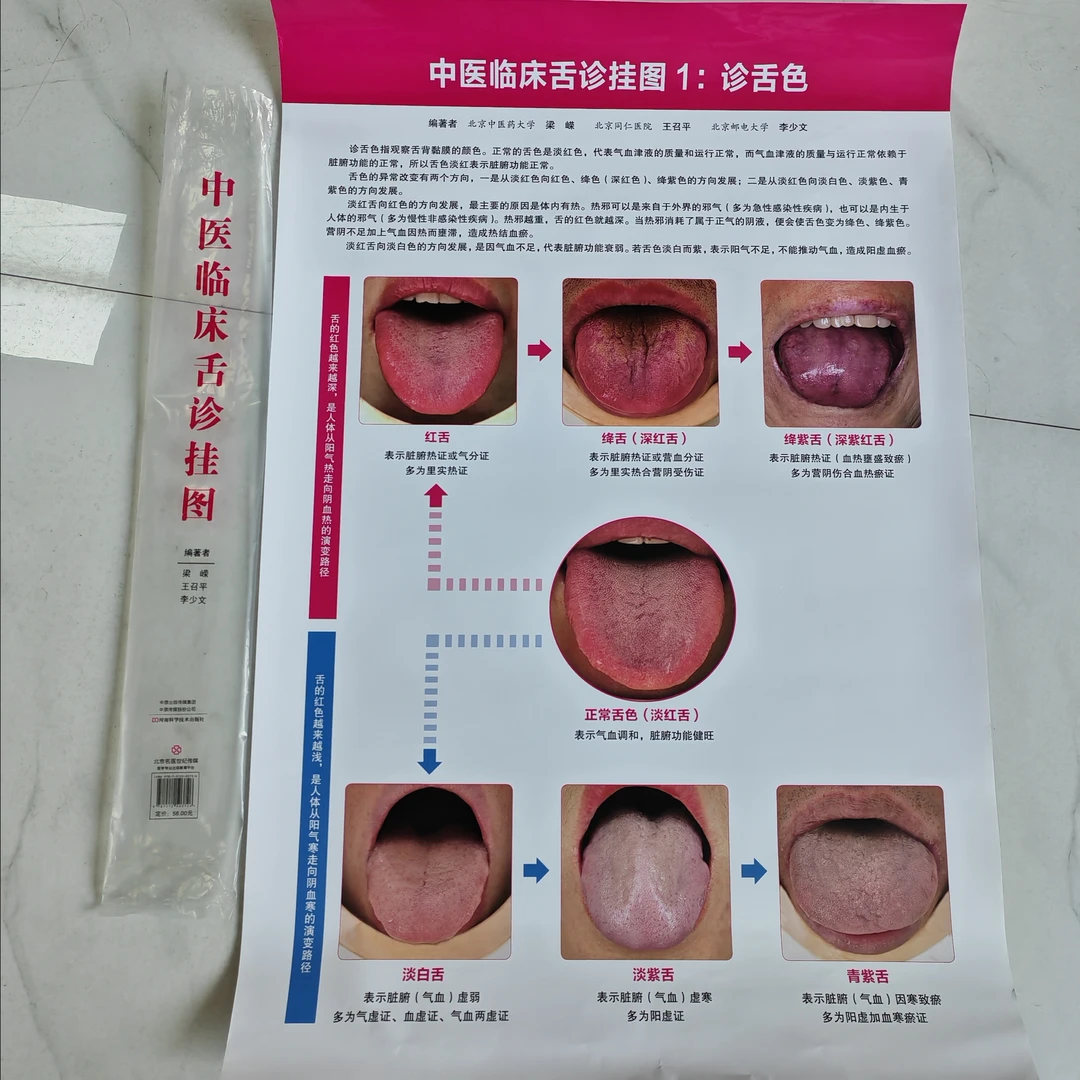 中医临床舌诊挂图 （一套4张）