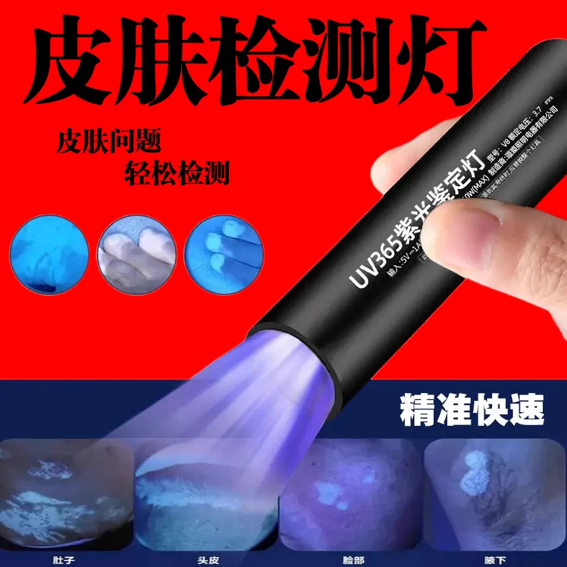 皮肤检测仪真菌癣黑头粉刺油脂测试灯家用专业皮肤伍德氏灯