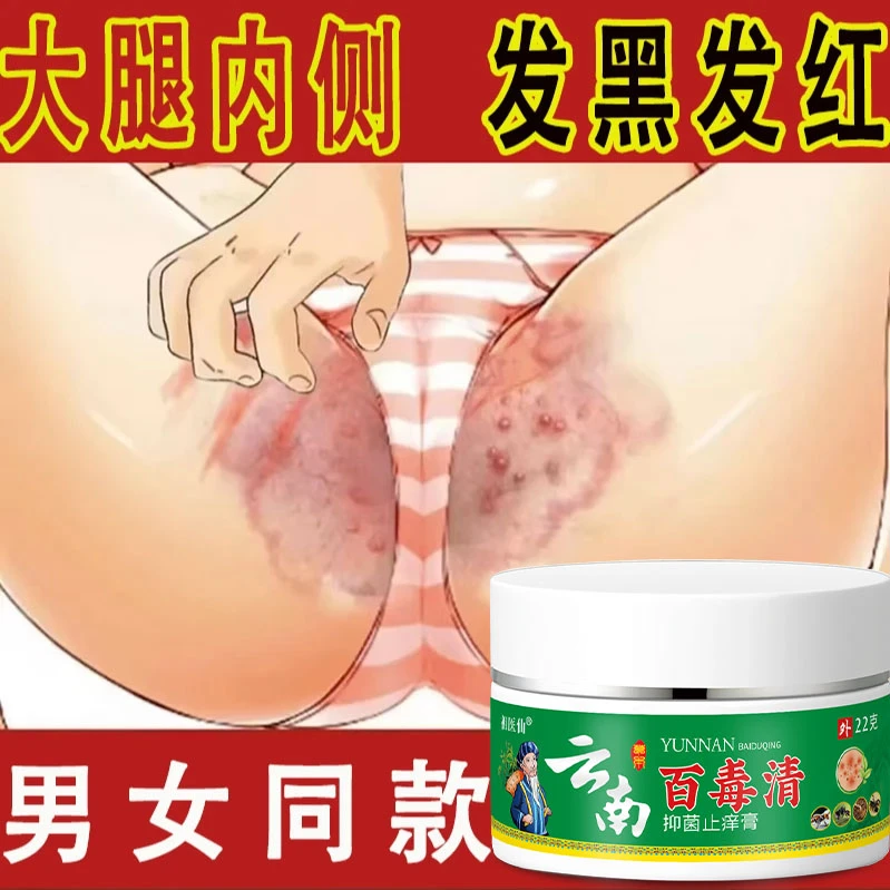 大腿内瘙痒止痒膏阴囊湿异味难闻舒适膏止痒膏皮肤抑菌止痒正品
