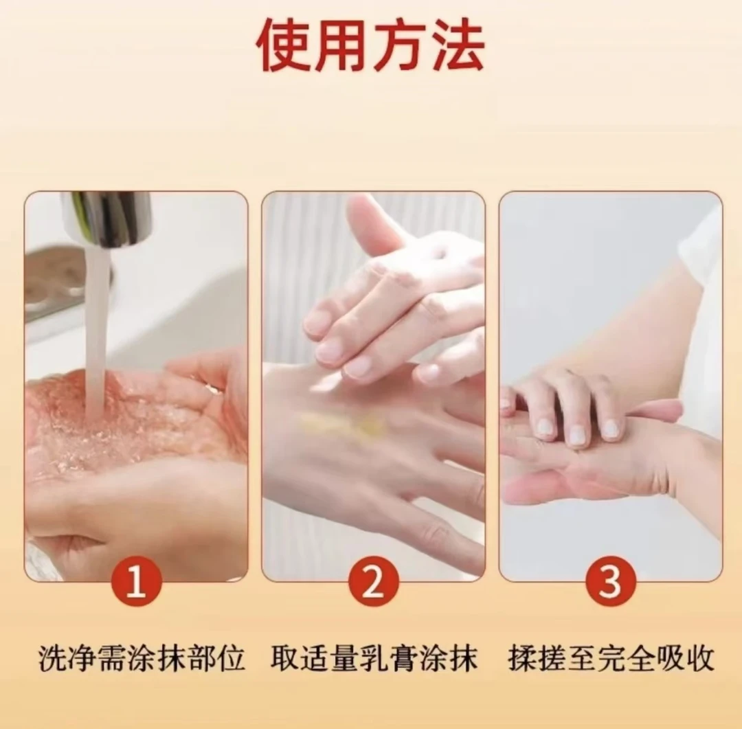 【支持试用】手上起小水泡很痒止痒膏脱皮抑菌手指缝痒干裂真菌感染