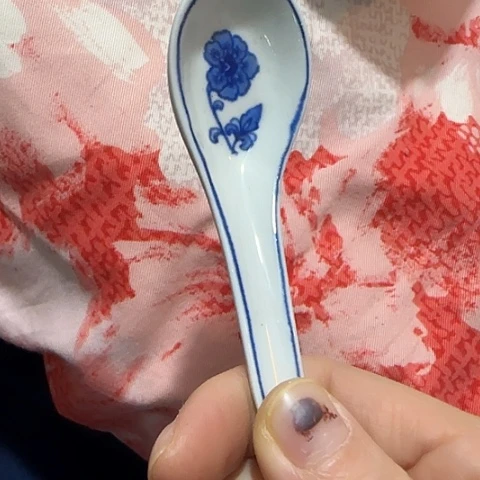 瓷片长**主国营厂库存微瑕