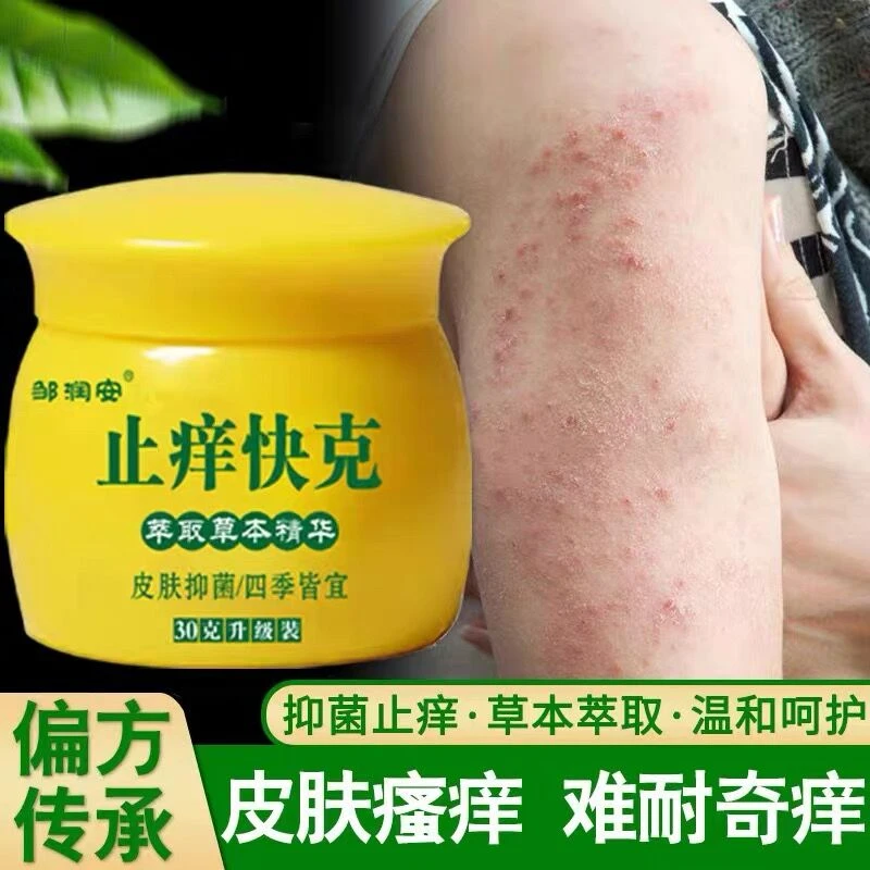 【官方正品】邹润安止痒快克草本抑菌乳膏大腿内侧痒皮肤外用止痒膏