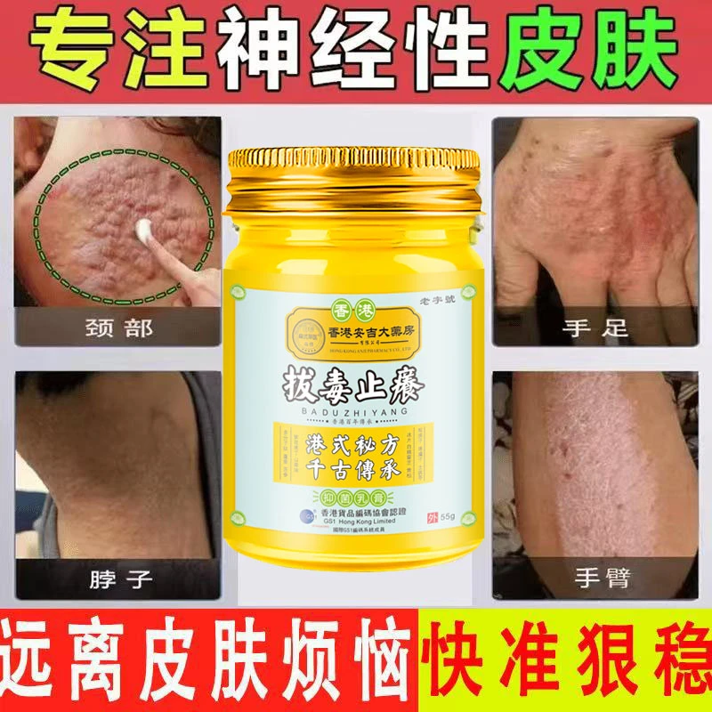 神经性皮肤痒脂溢性皮肤日光性皮肤止痒膏全身可用涂抹止痒抑菌膏