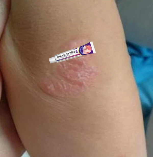 百草膏小腿上皮肤手上脚上身上胳膊大腿全身适用外用护理草本乳膏