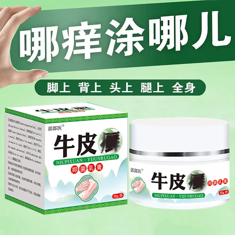 牛皮膏王银痒痒膏屑手足大腿内侧全身皮肤瘙痒外用抑菌止痒乳膏