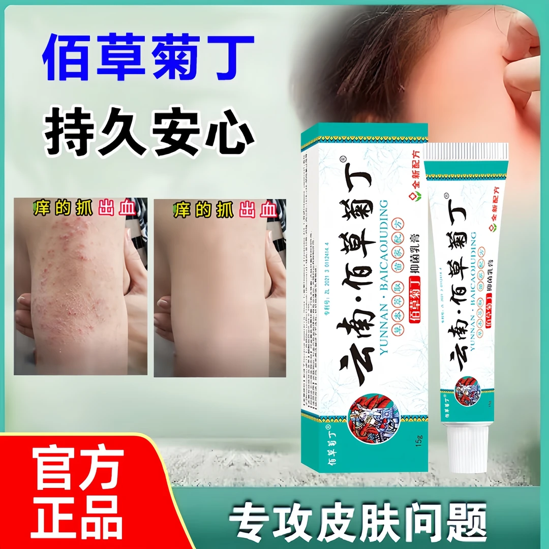 官方正品【云南佰草菊丁】大腿内侧瘙痒越抓越痒大腿止痒膏男去潮湿