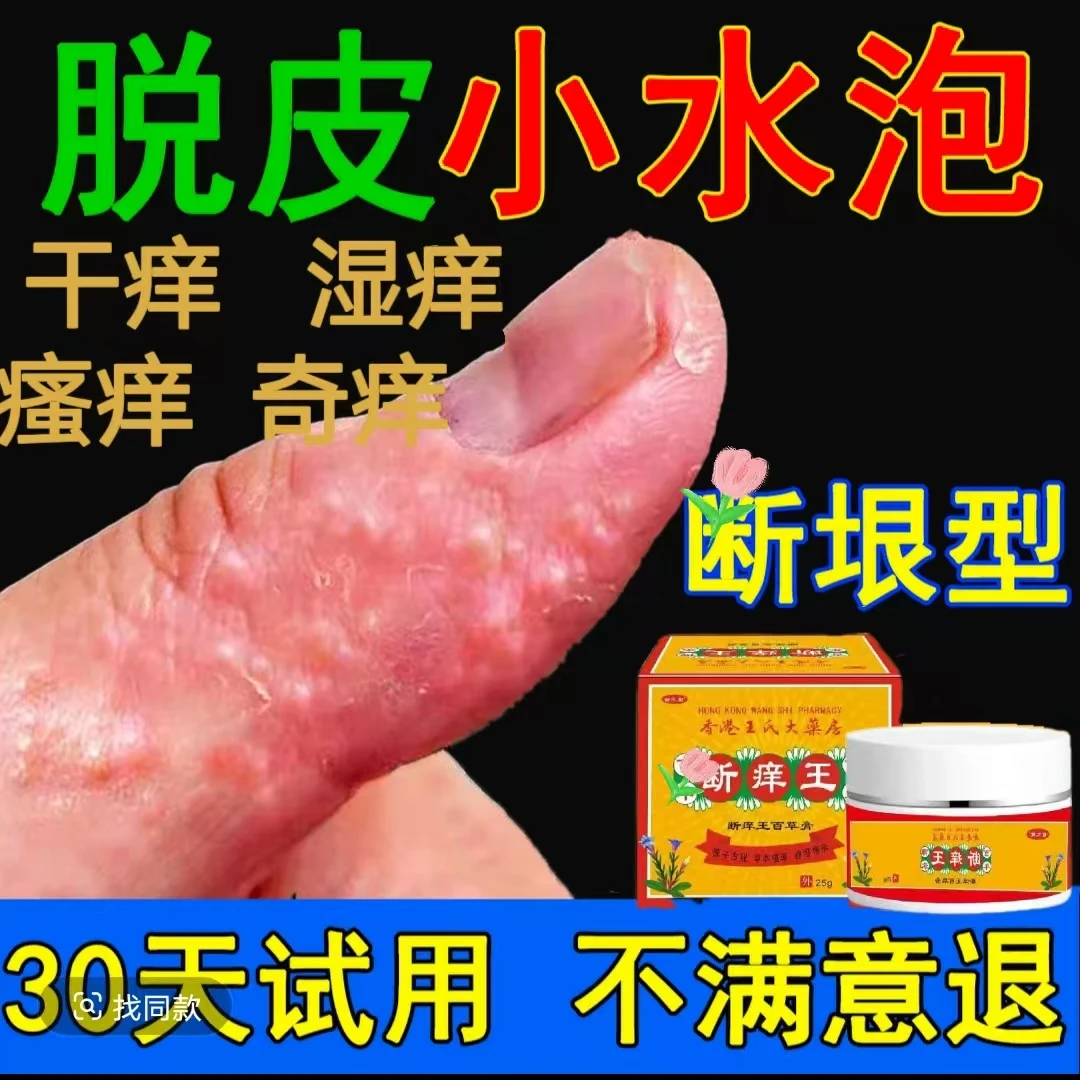 皮肤瘙痒湿痒止痒膏大腿内侧手起水泡瘙痒的止痒膏全身红断痒王