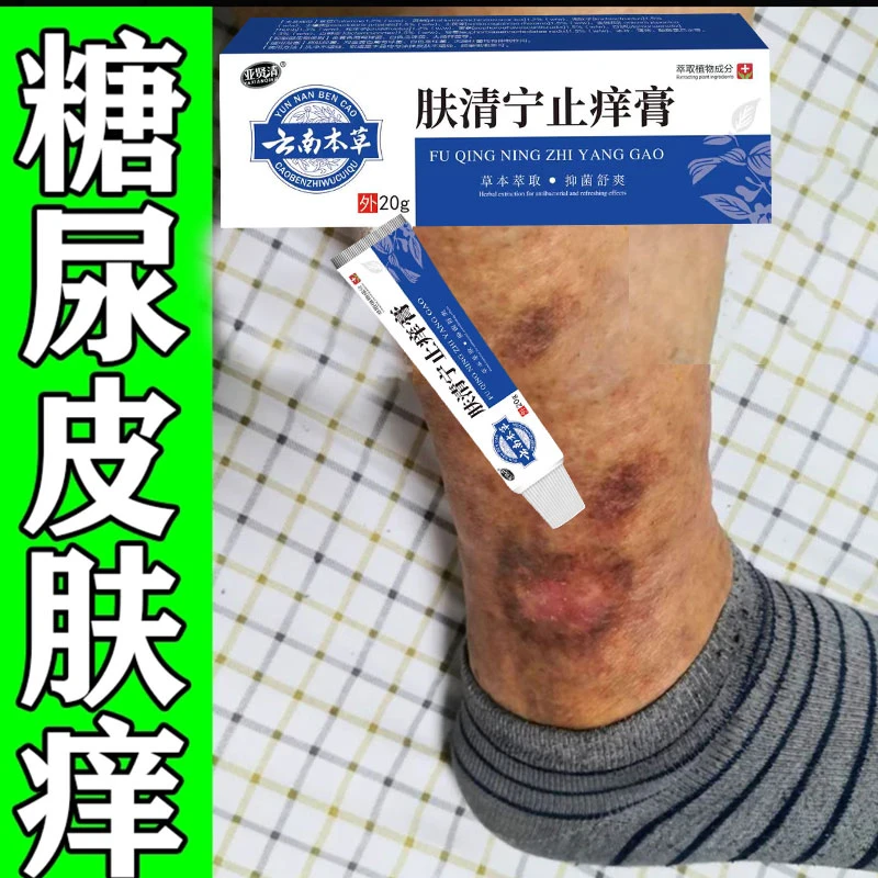 糖尿中老年人皮肤瘙痒止痒膏皮肤干燥脱皮越挠越痒血糖高外用止痒