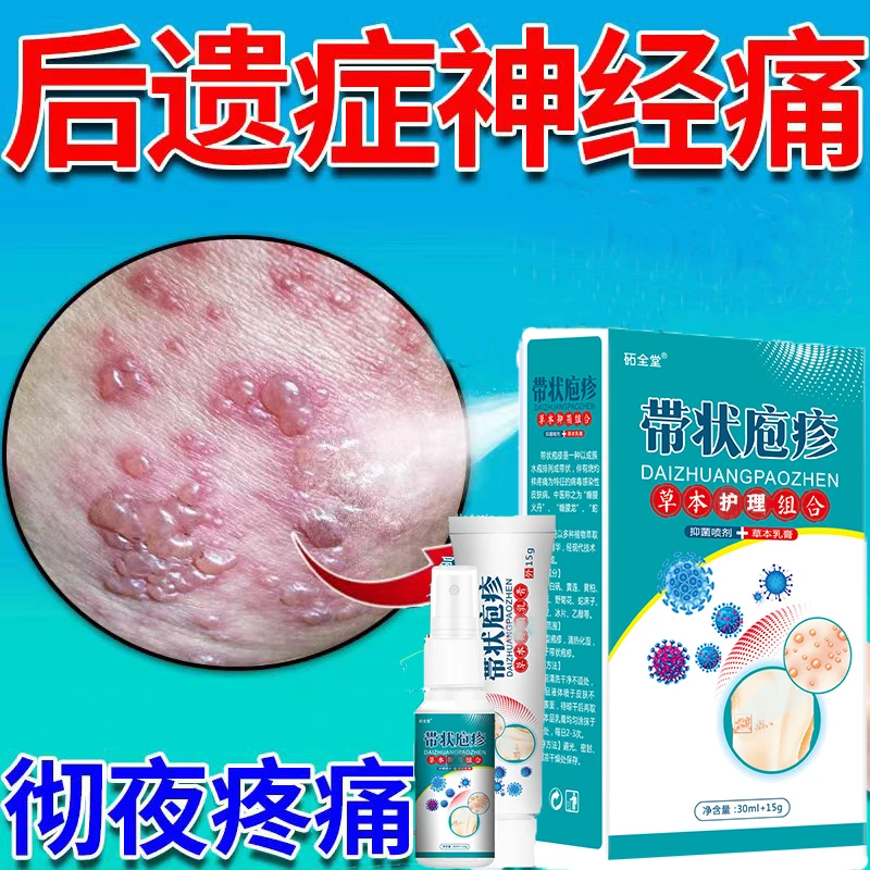 带状疱疹泡疹蛇盘疮专用蛇缠膏后遗症神经痛疼特效外用膏