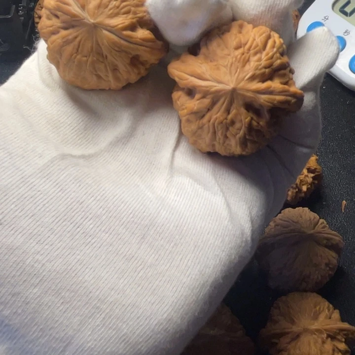 @***下吊坠骨质密度没问题