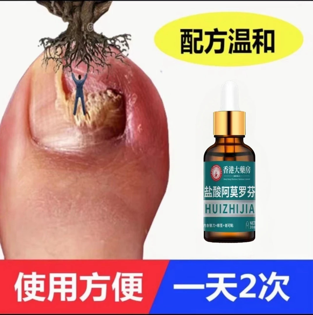 【官方正品】阿莫.罗.芬指甲护理手足指甲发灰发黄变黄深层抑菌擦剂