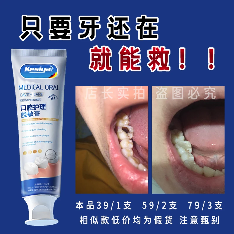 【牙膏界的佼佼者】德国牙膏牙黄牙黑敏感大牌护理牙膏KSY5