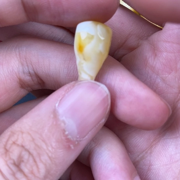 未镶嵌琥珀裸石微瑕39