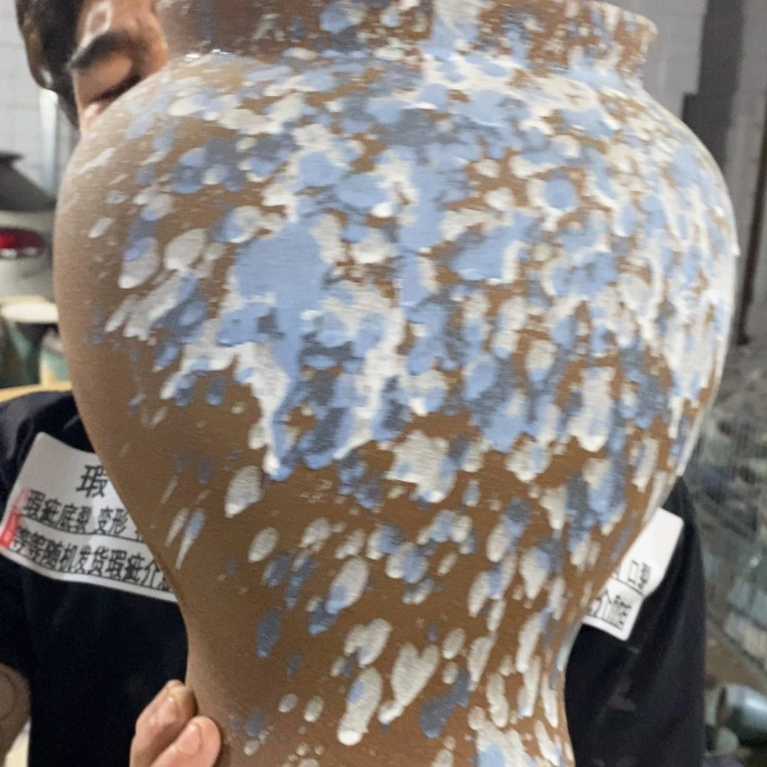 瑕疵17/28，hhxbxnx