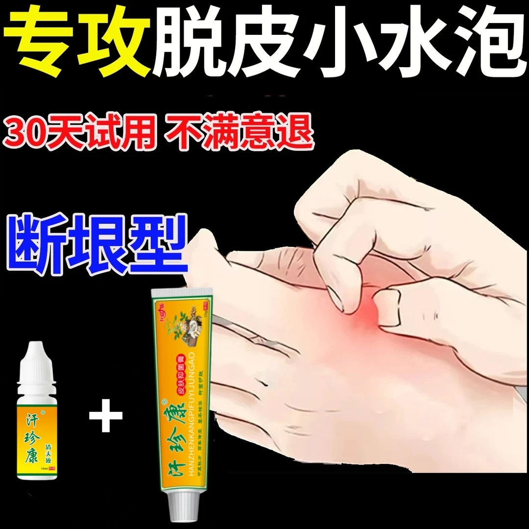 手上起小水泡止痒膏脱皮抑菌克星手指缝痒干裂汗珍泡专用喷剂特效