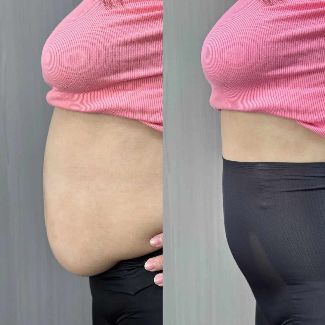 LIANGCTHEREE塑形收腹裤弹力夏季透气大码女装提臀轻薄