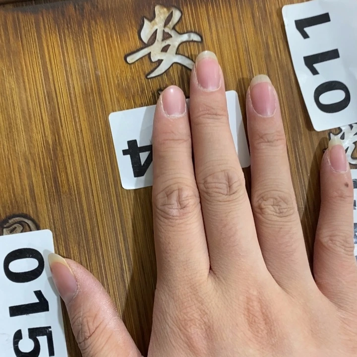 紫砂——————————————————-