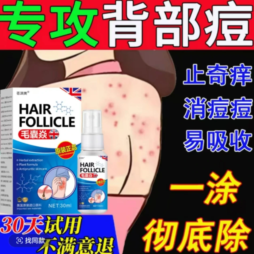 胸前后背上毛囊痘脖子头皮去除全身止痒专用皮肤抑菌喷剂神器