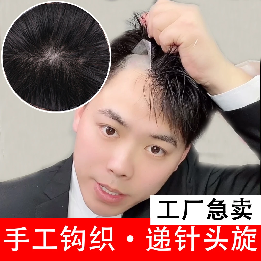 男士假发补发片头套秃顶递针手织真发毛寸翻盖假发补发块生物头皮