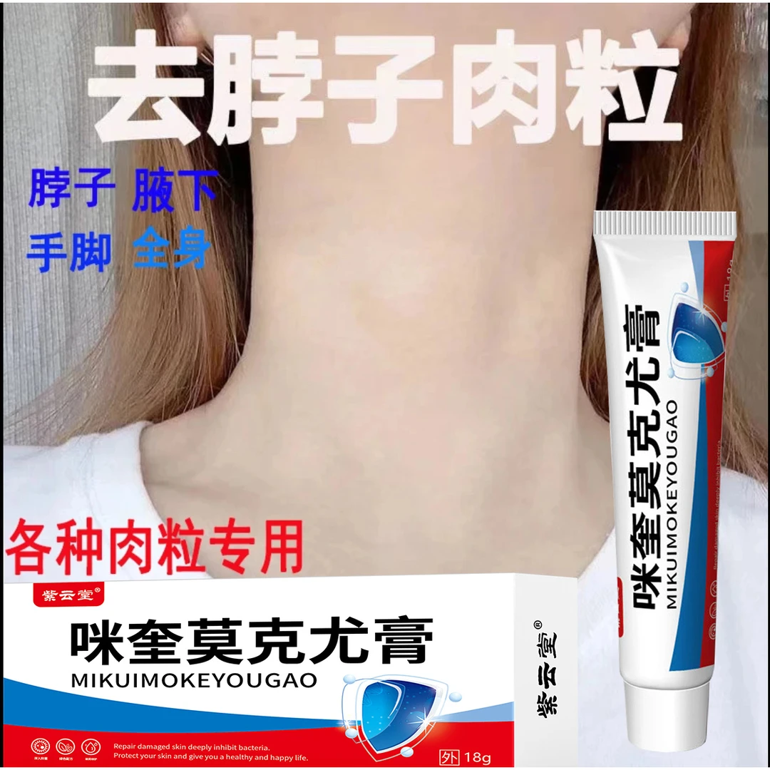 米奎5%莫克尢膏米奎扁平丝状腋下寻常草本脖子上长小肉粒咪奎