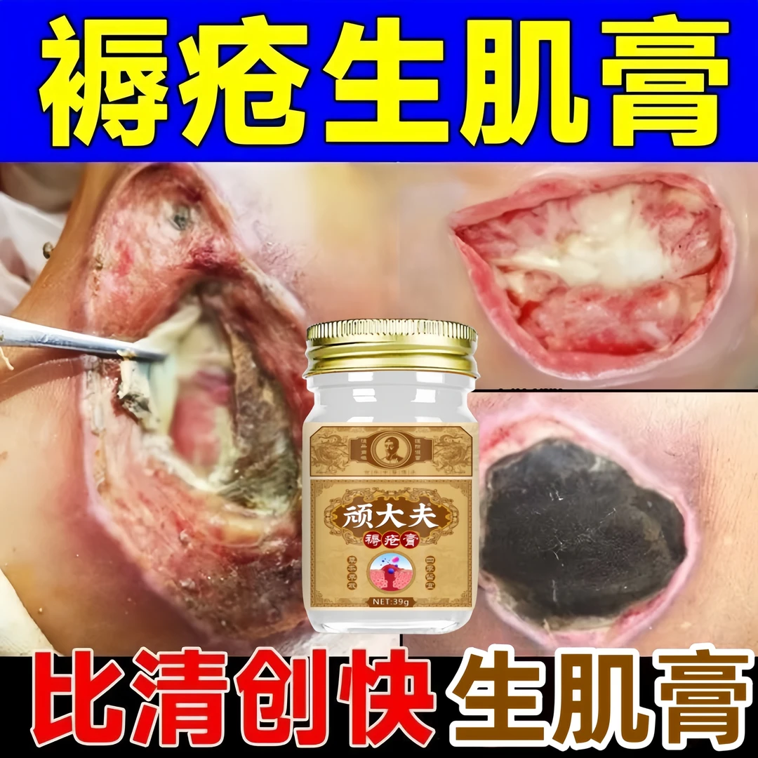 褥疮膏特效进口去腐拔毒压疮膏伤口愈合糖尿足老人臀部重度老烂腿