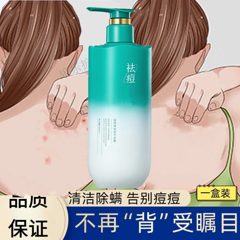 祛痘沐浴露后背前胸祛痘印背后痘痘粉刺男女士专用清洁控油保湿
